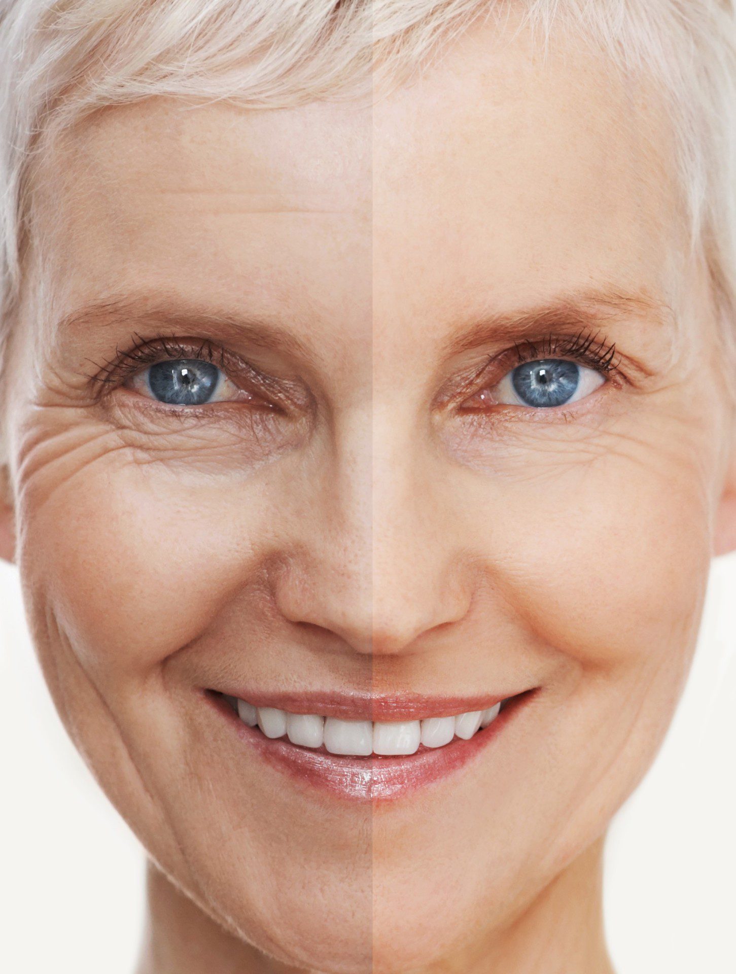 Older woman, split-face, wrinkles vs no wrinkles